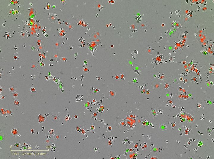 Breast Cancer Sleeper Cells