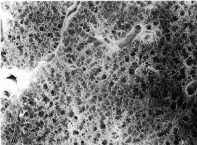 Normal Lung
