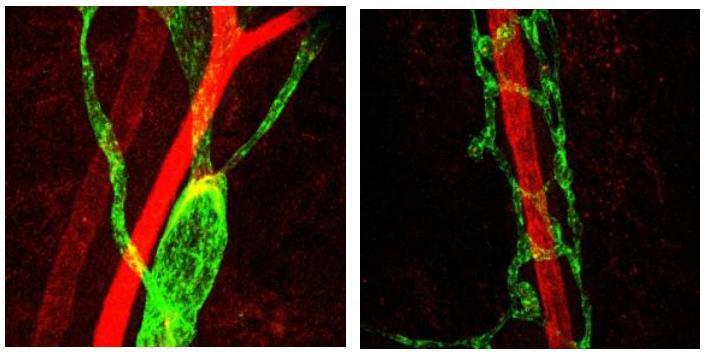 Figure 2: Lymphatic Vessels