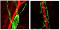 Figure 2: Lymphatic Vessels