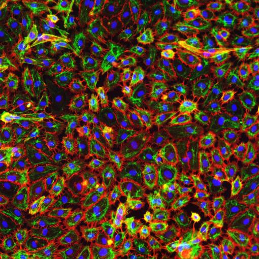 Blood Outgrowth Endothelial Cells