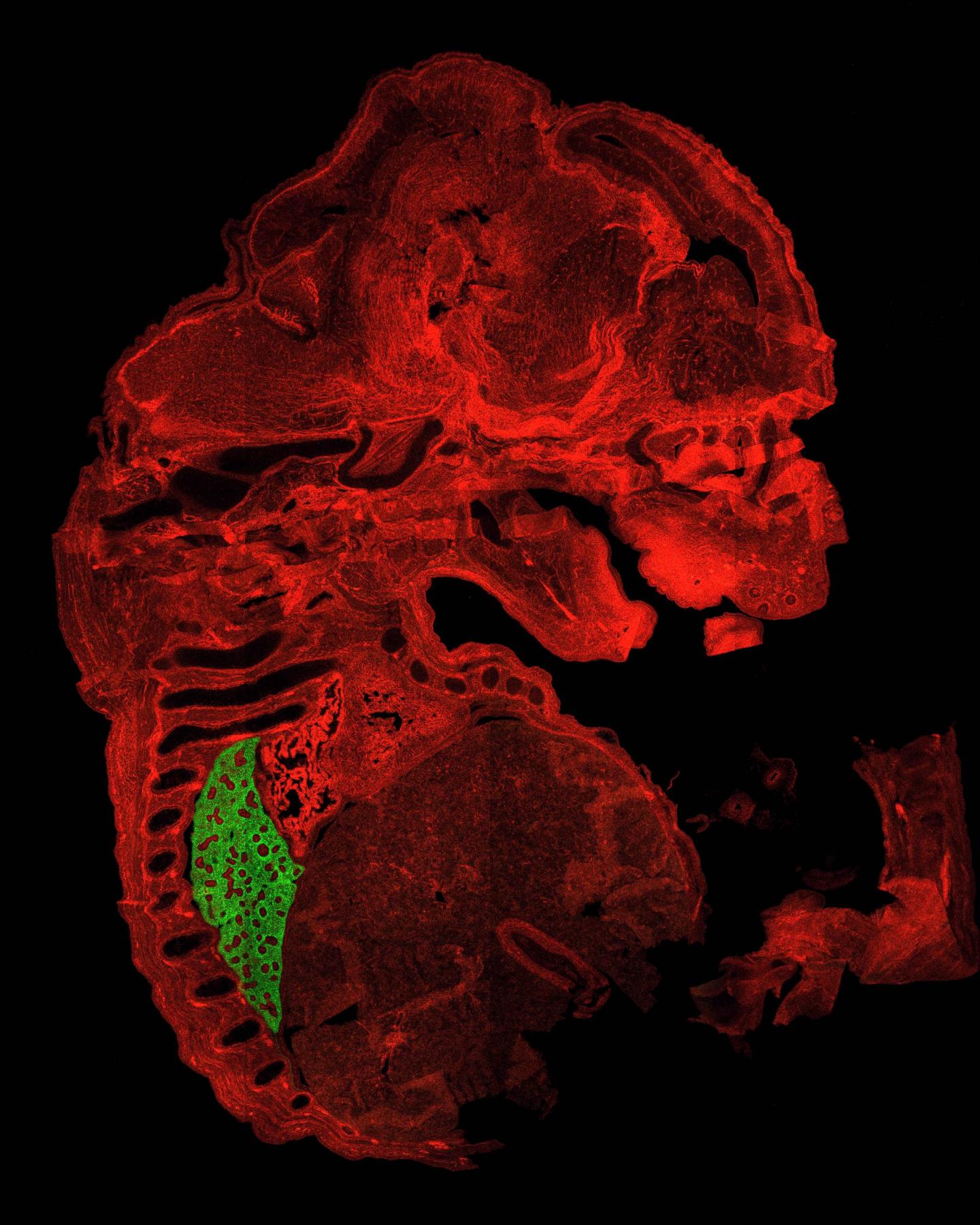 Transgenic Mouse Model