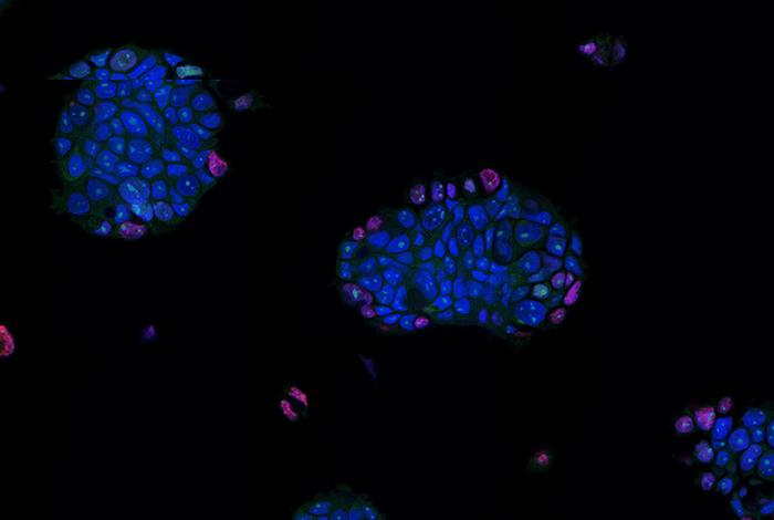 Tumor Organoid Tech Advances Toward a Sci-Fi Future
