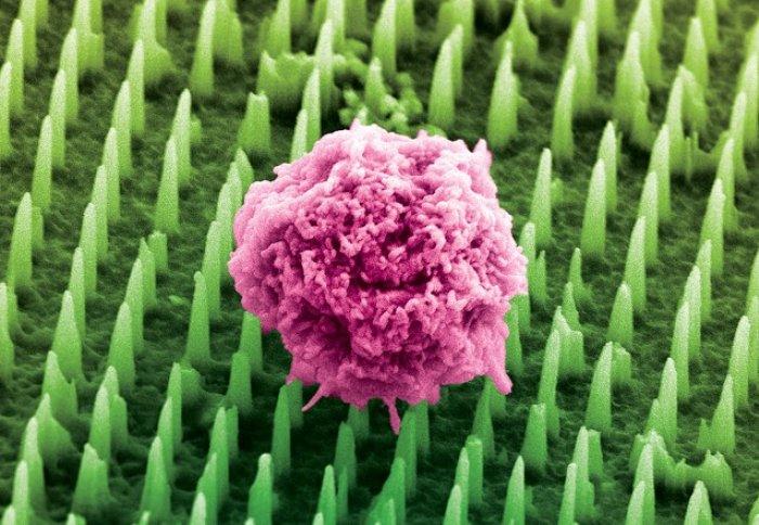 Colourised image of Nanoneedles