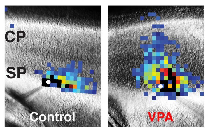 Control vs. VPA Treatment