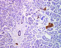 Healthy Pancreas Tissue