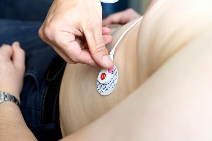 ECG data predicts deadly surgical complications