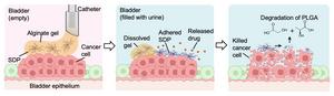 An illustration of how new soft-dendritic particles could be used to treat bladder tumors