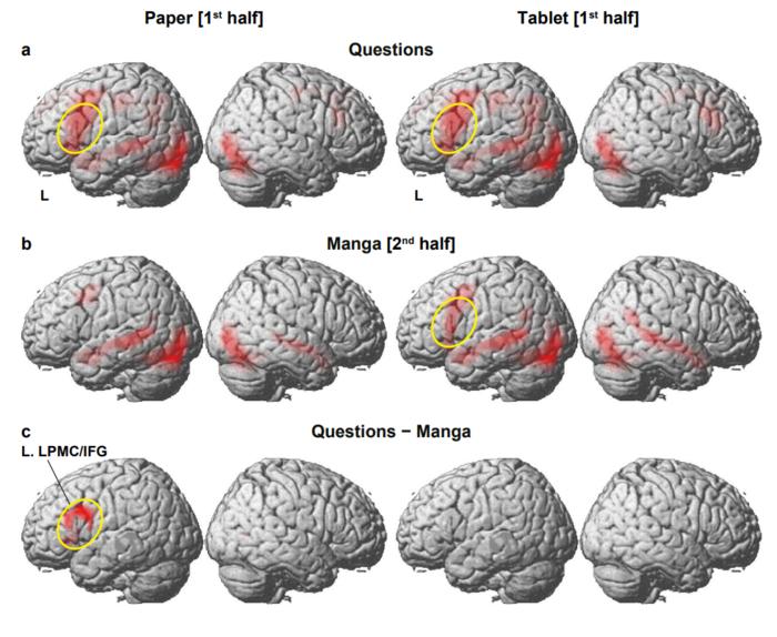 Brain regions engaged