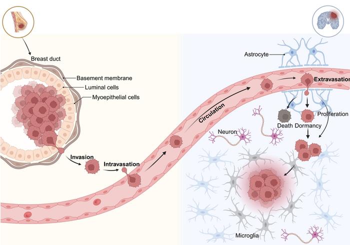 The metastatic cascade of BCBrM