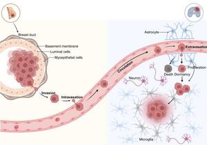 The metastatic cascade of BCBrM