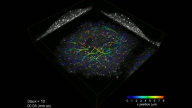 New Microscope Peers at Subcellular Gears in Action (7 of 8)