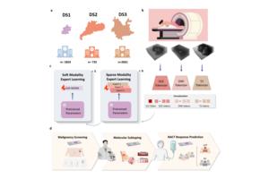 Using multiparametric breast MRI data from three hospitals, the research team developed the MOME model to enable non-invasive malignancy classification, molecular subtyping, and neoadjuvant chemotherapy response prediction for personalized breast cancer m