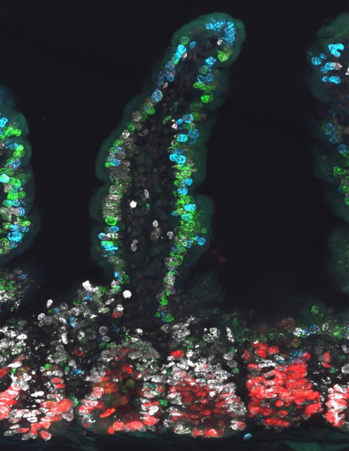 Intestine