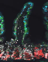Intestine