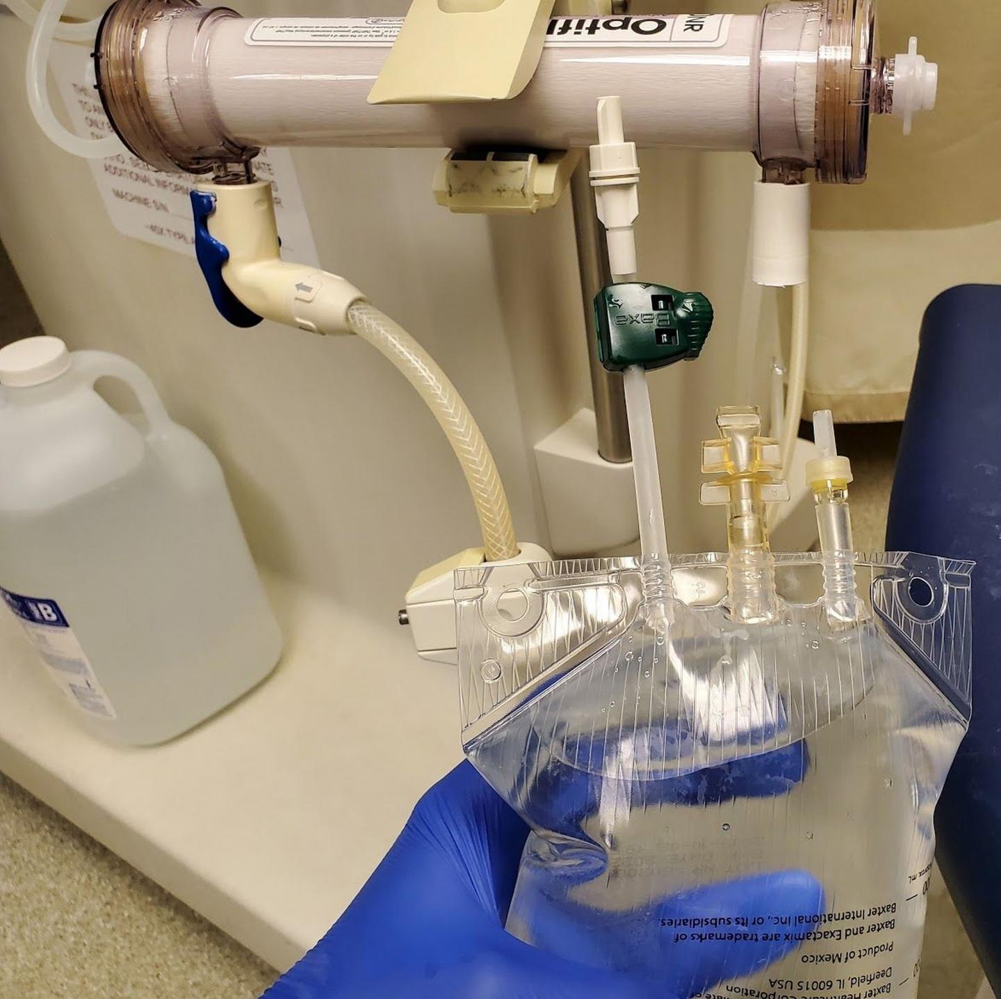Novel Hopkins Method for Making Dialysate