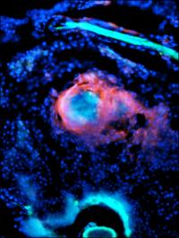<i>Mycobacterium marinum</i> Infection in Zebrafish (1 of 2)