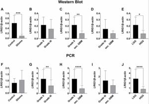 LRIG1-3 in gliomas: LRIG1 protein expression decreased in higher grade gliomas