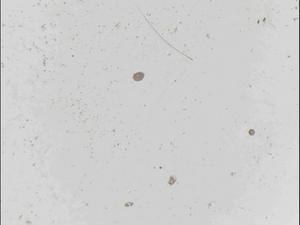 Edwardsiella carnea planulae, excised from the medusa-host, swimming in the seawater (x25).