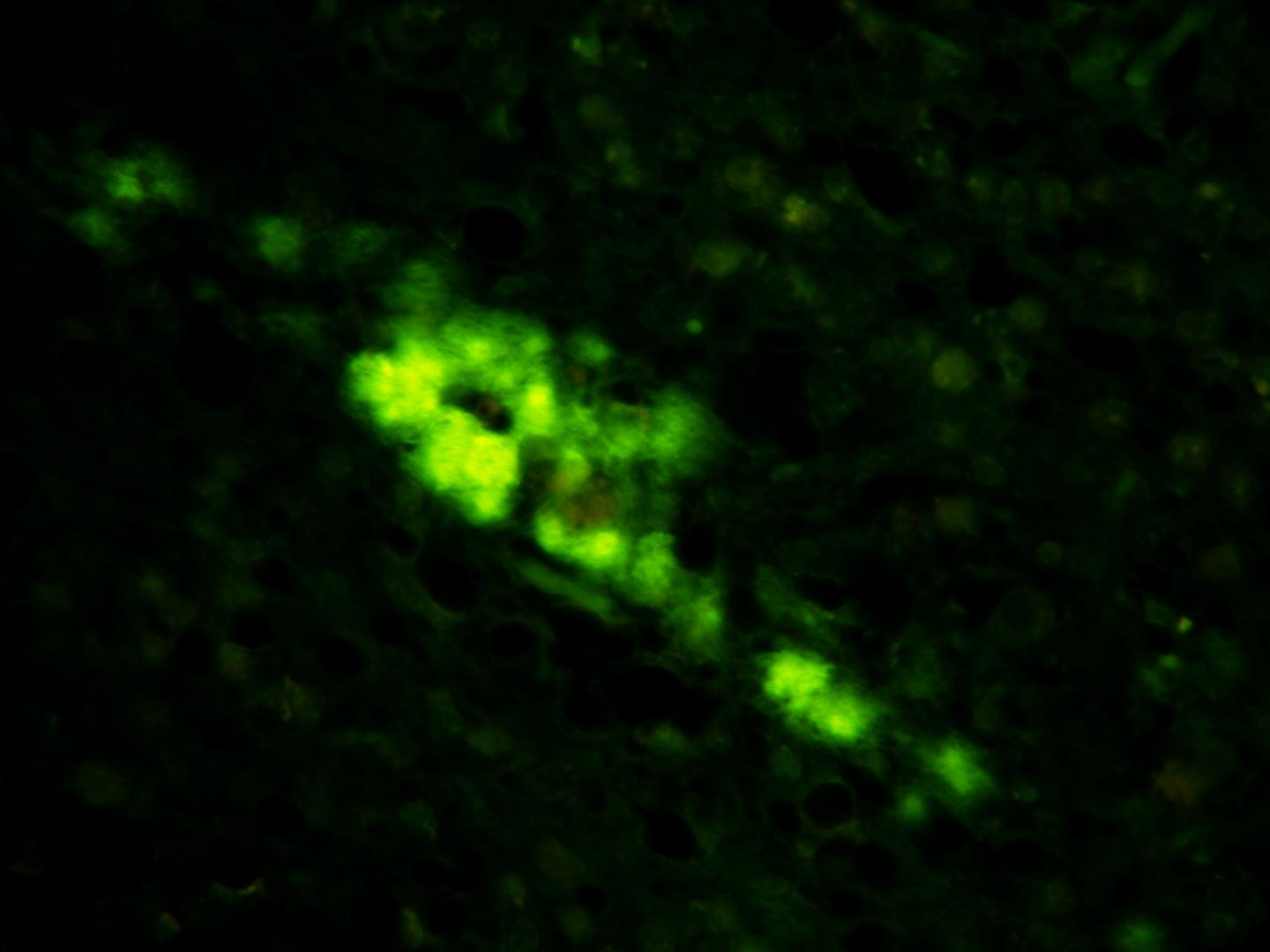 Synthetic Human Prions