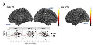 FOXP1 Hypermethylation Correlates with Gray Matter Changes in Emotional Regulation, Memory Retrieval, and Social Cognition Regions of the Brain