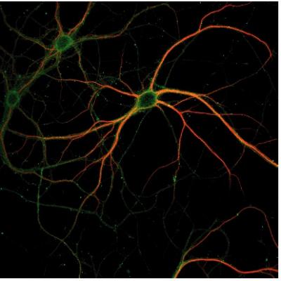 Neuron