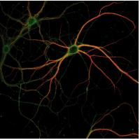 Neuron
