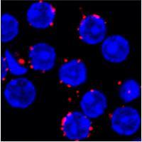 Organized in Protein Islands Which Coalesce when the BCR Recognizes a Threat