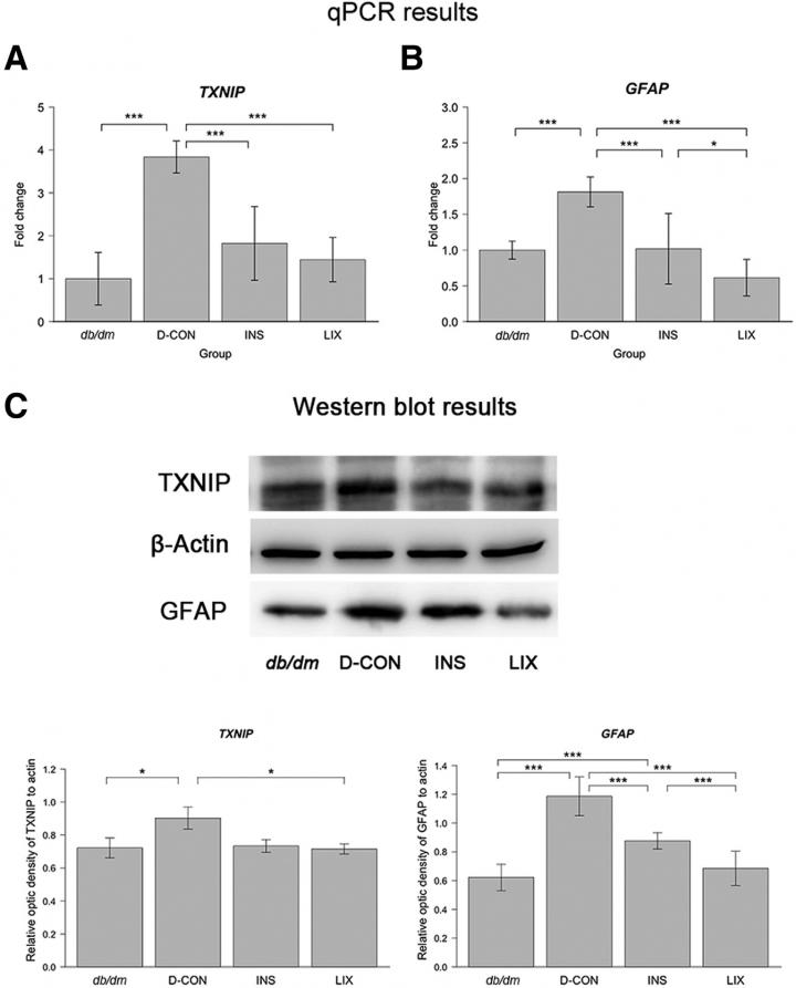 Scientists Identify a Potential Treatment Candidate for Early Type 2 Diabetic Retinopathy
