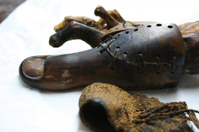 Prosthesis
