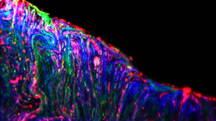 Microorganisms feel at ease in biofilms. In the microscope image, they are marked in different colors