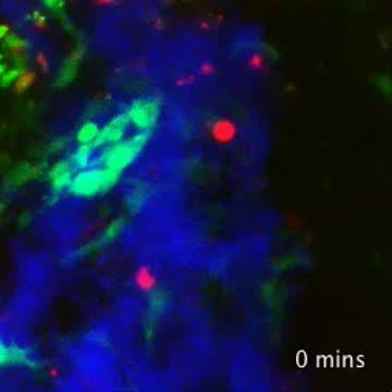 Leukemia Cell Movement
