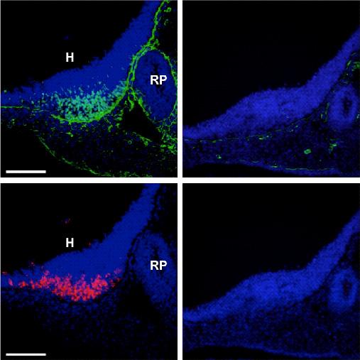 POMC Cells