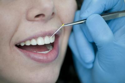 Quick Detection of Periodontitis Pathogens