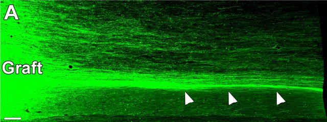 Graft Axons, Mark Tuszynski, UC San Diego School of Medicine