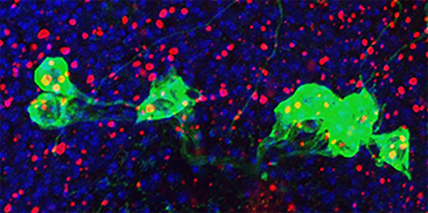Understanding Aging Brain Disorders