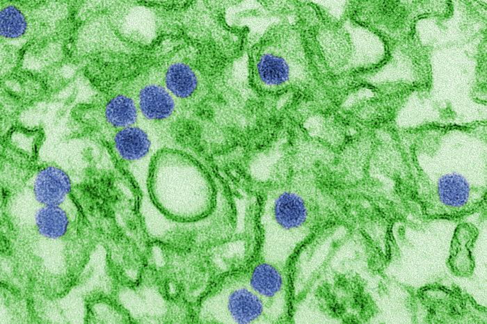 Zika Virus EM