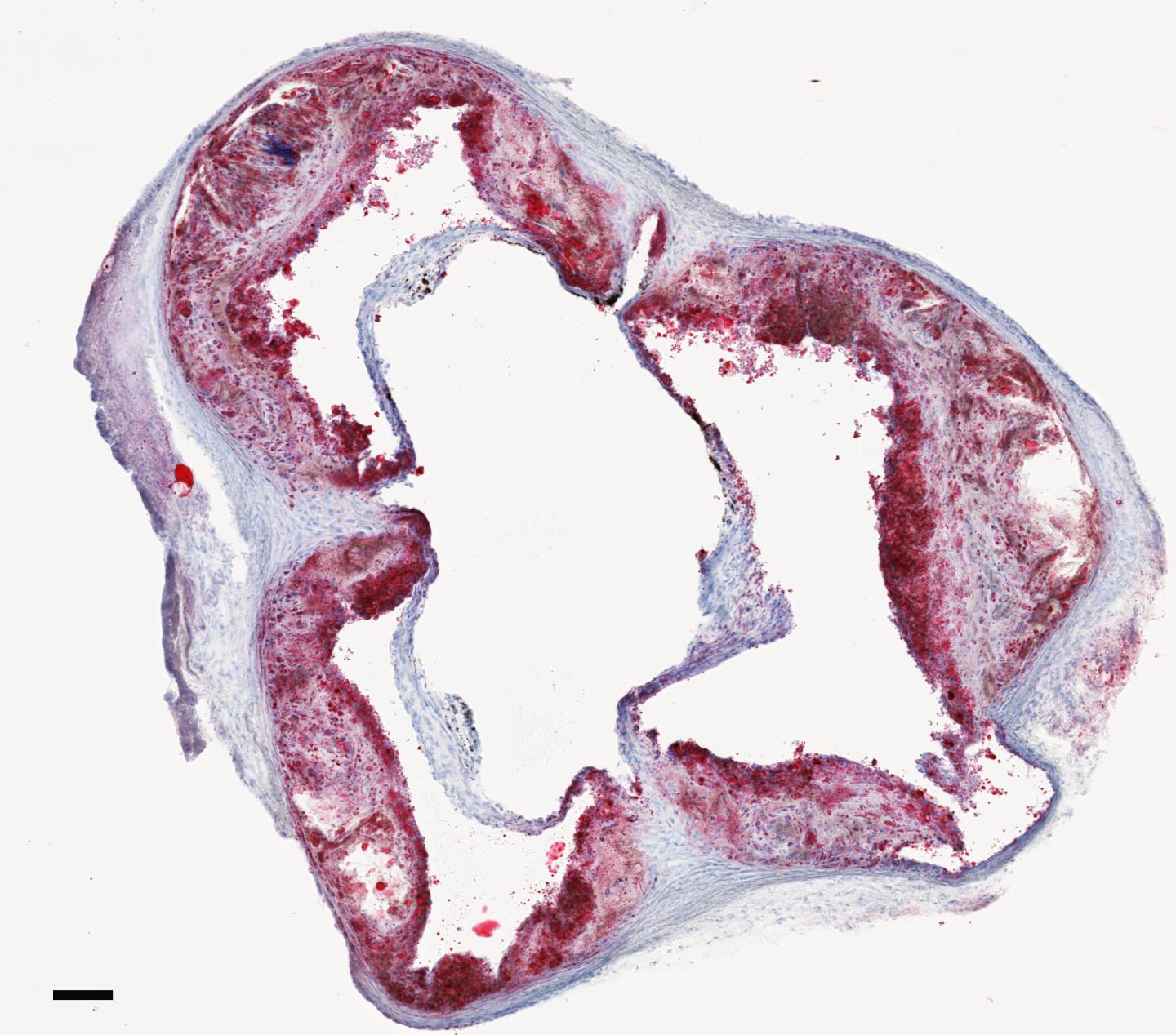 Atherosclerotic Mouse Aorta