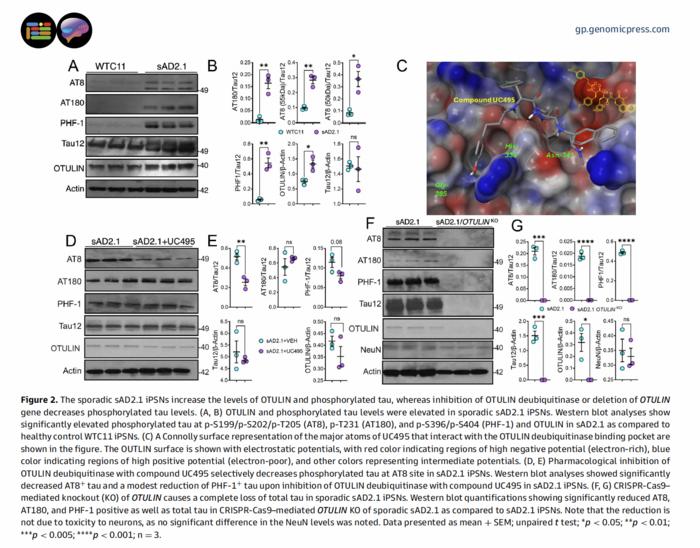 The sporadic sAD2.1 iPSNs increase the levels of OTULIN and phosphorylated tau, whereas inhibition of OTULIN deubiquitinase or deletion of OTULIN gene decreases phosphorylated tau levels.