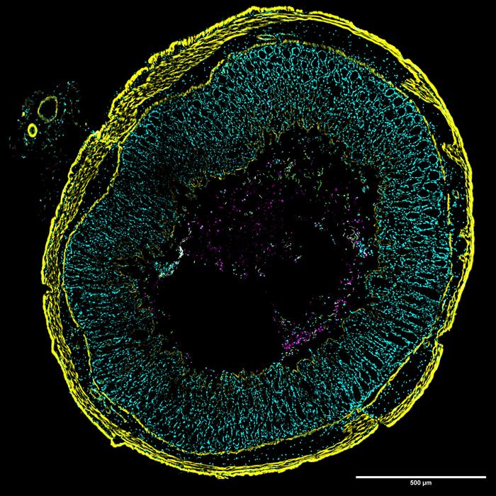New  imaging approach for studying C. diff