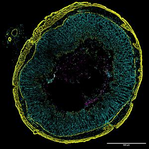 New  imaging approach for studying C. diff