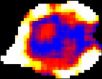 Glucose