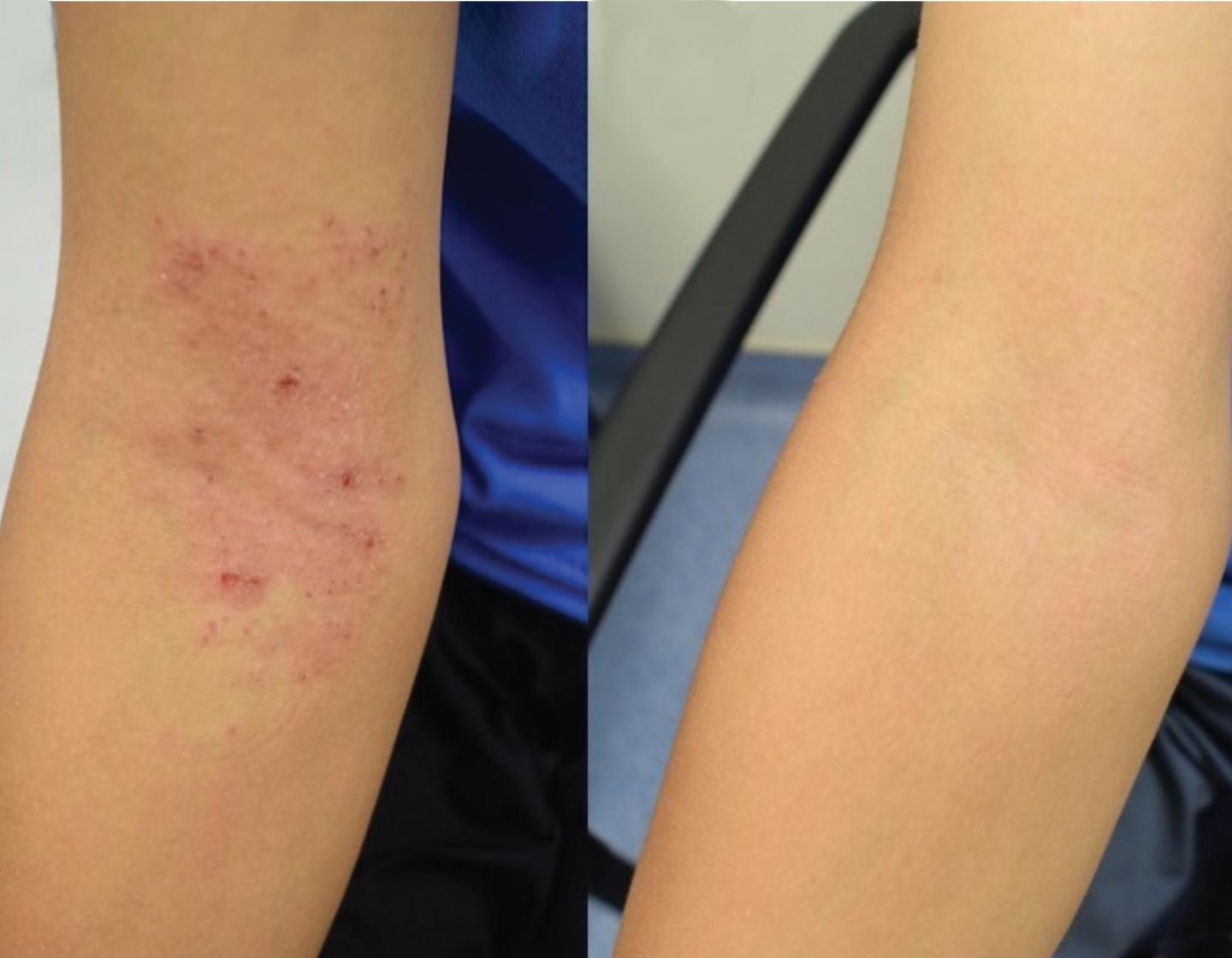 Before and after
