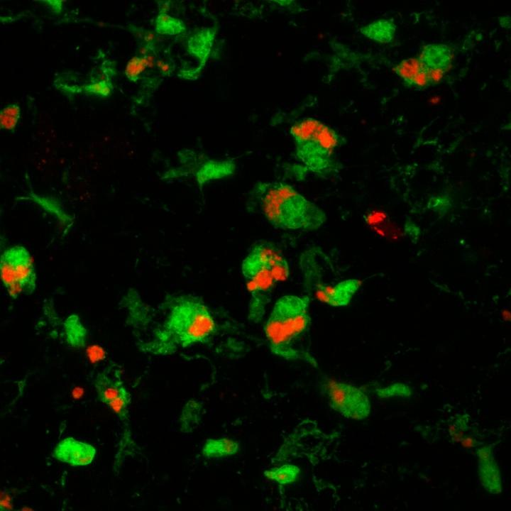 Microglial Cells