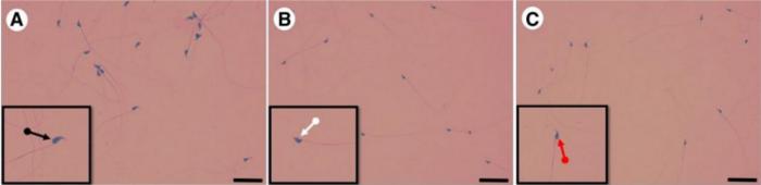 Microscopy images show sperm appearance in three groups.