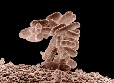 E. coli