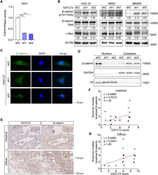 GXYLT2 knockdown suppressed Wnt/β-catenin signaling pathway.