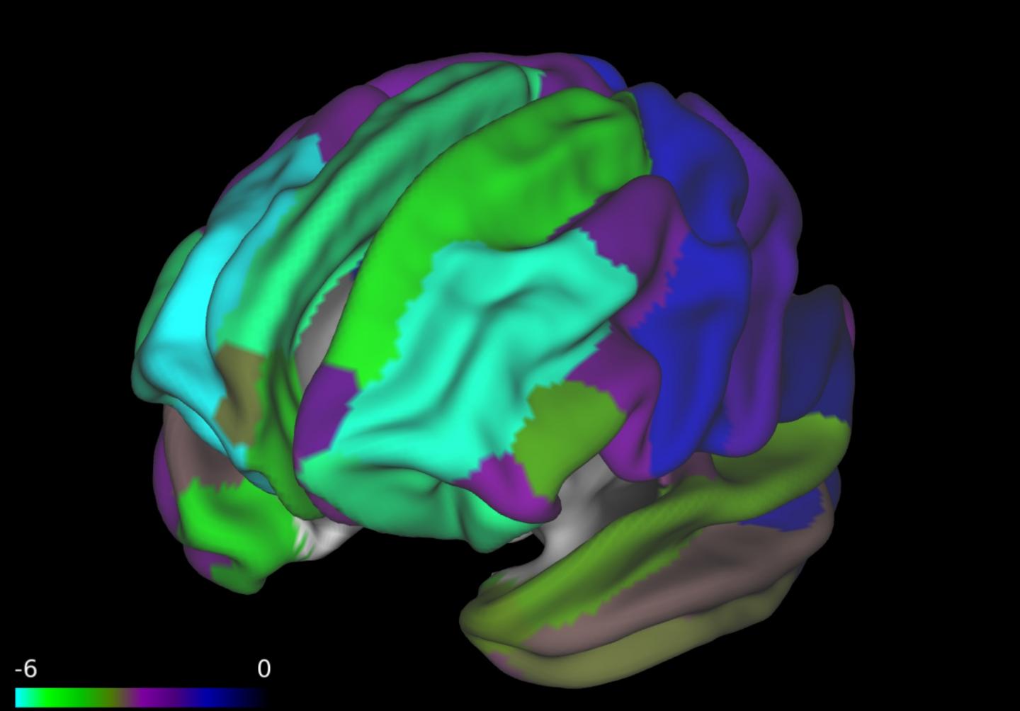 A Bran Scan from a New Study Shows a Thinner Prefrontal Cortex in Children with Higher BMI
