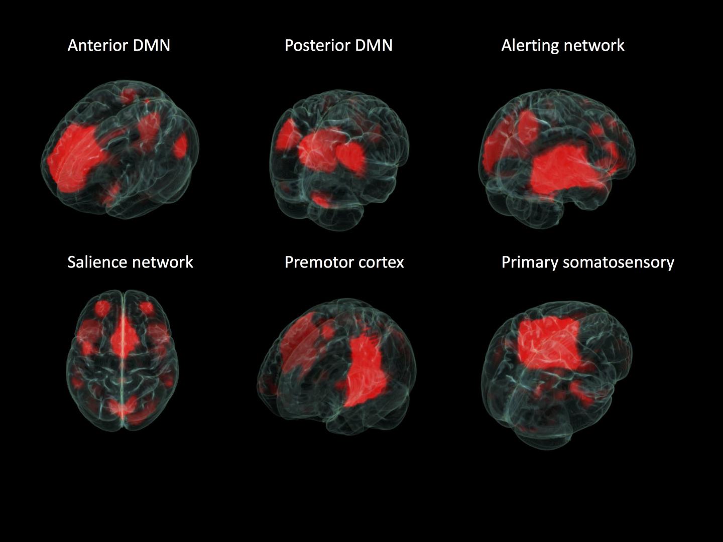 Brain Mapping
