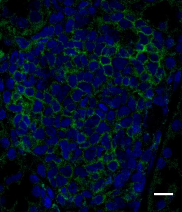 Salivary glands of a Down syndrome mouse model